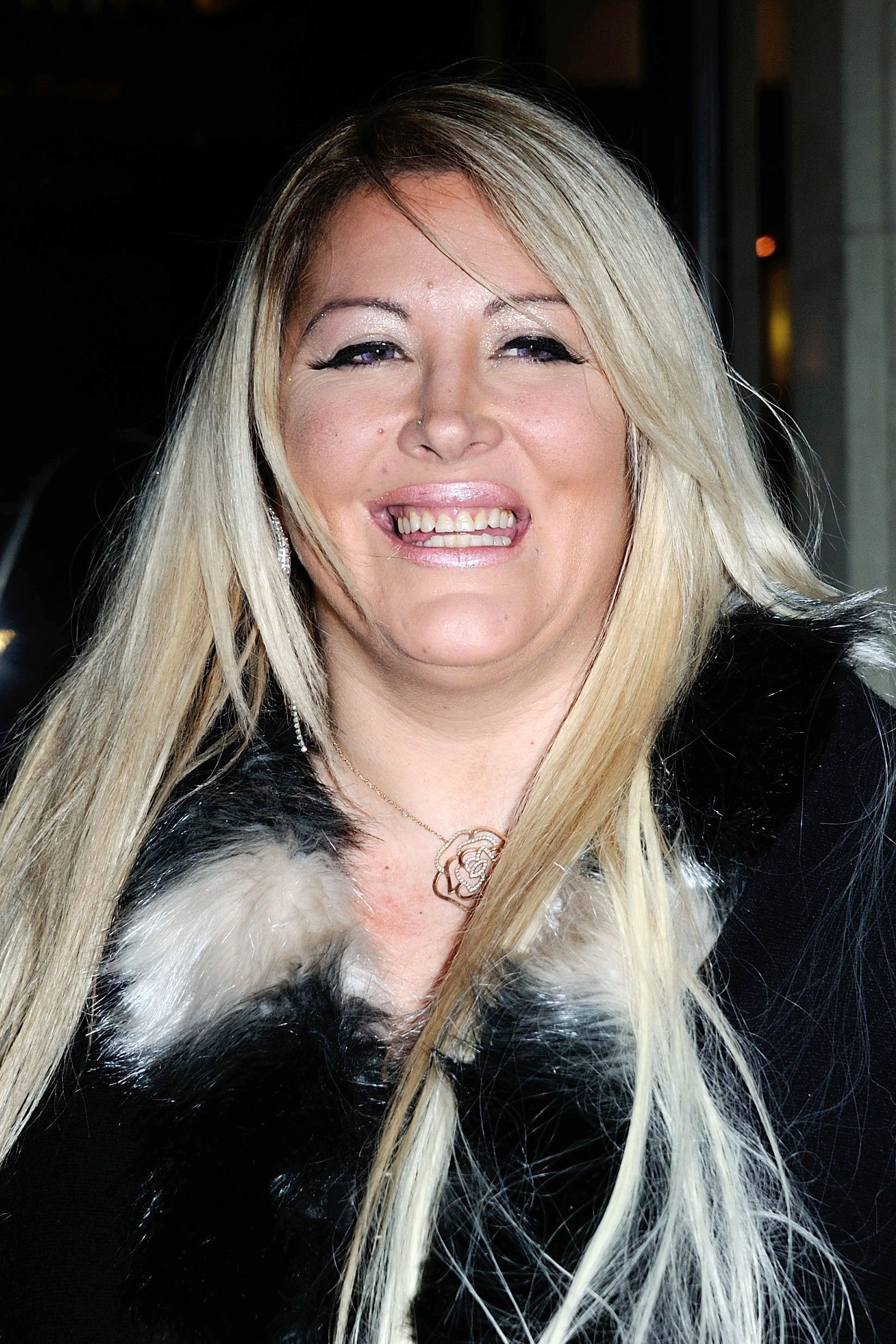 Loana avant / après son opération de chirurgie esthétique ...