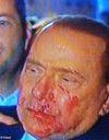 Silvio Berlusconi, en sang à la une de la presse italienne
