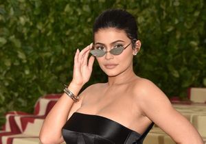 Kylie Jenner retire ses injections des lèvres, découvrez ces stars qui ont regretté la chirurgie esthétique 