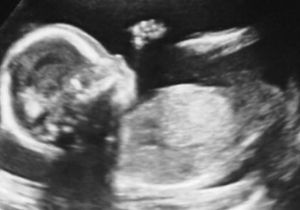 Les Instagram de la semaine : mais qui est enceinte ?