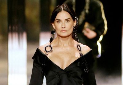 Chirurgie esthétique : ces stars qu'on ne reconnaît plus