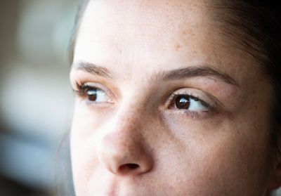 Chirurgie esthétique : « J'avais l'air sévère »