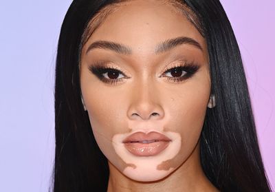 Winnie Harlow lance sa marque de produits solaires