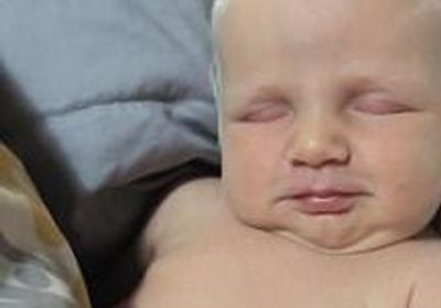 Ce Bebe Ne Avec Des Cheveux Blancs Cree Le Buzz