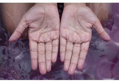 Pourquoi nos doigts se fripent-ils après quelques minutes dans l’eau ?