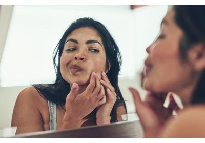 La vérité sur l'acné : on vous explique pourquoi votre crème anti-boutons ne marche pas