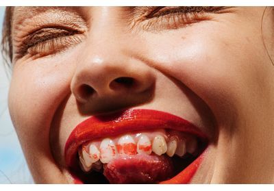 Épilation, colorations, chirurgie et muscu : comment coacher nos ados ?