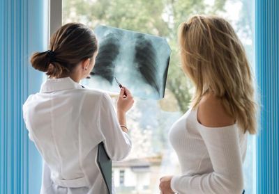 Cancer du poumon : le dépistage des femmes au coeur d'une étude