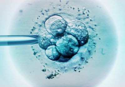 De la ponction à l'embryon, reportage dans un centre de PMA entre espoirs et doutes