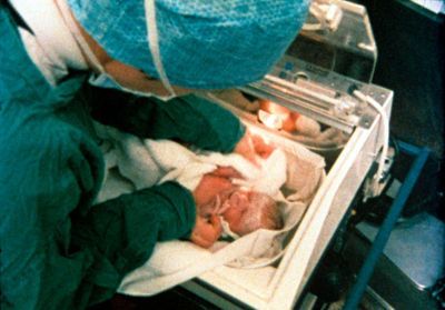 PMA : de la prouesse scientifique au premier bébé