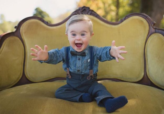 Asher, le bébé trisomique de 16 mois devenu top model 