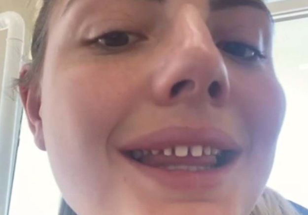Tiktok La Tendance Dangereuse De Se Limer Les Dents Pour Avoir Un Sourire Parfait Elle