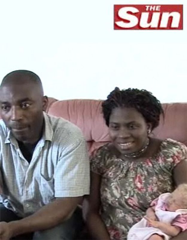 Des Parents Noirs Donnent Naissance A Un Bebe Blanc Elle