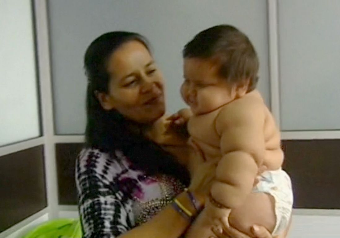 Santiago Ce Bebe Colombien De 8 Mois Qui Pese Kilos Elle