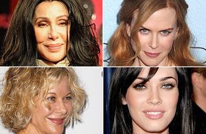 Stars : toutes accros au Botox ?