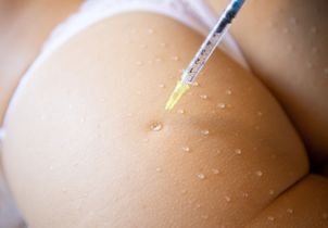 Qu’est-ce que le « BBL Filler », cette technique d'injections dans les fesses qui inquiètent les médecins ?