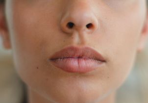 Que faire à 30 ans ? Les traitements de médecine esthétique recommandés par un médecin
