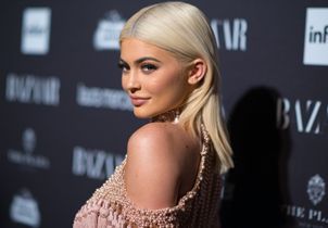 « Lip filler accent » : cette nouvelle façon de parler inspirée par les injections intrigue les experts