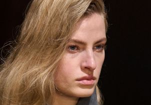 Cernes persistants : ce que les dermatologues recommandent vraiment pour les atténuer