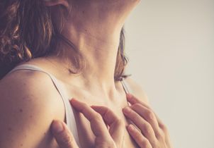Coaching beauté : comment éviter qu’une cicatrice reste visible pendant des années ?