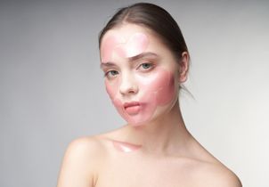 Faut-il se méfier des peelings maison qui font le buzz sur TikTok ?