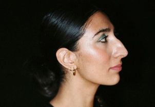 Bossu, crochu, « patate »… La revanche des femmes aux nez « atypiques »