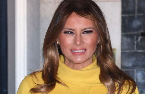 Elle dépense 65 000 $ en chirurgie esthétique pour ressembler à Melania Trump, le résultat est étonnant