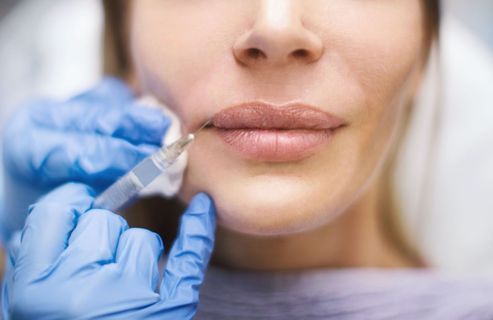 Qu’est-ce que le Russian Lips, cette technique pour des lèvres pulpeuses qui fait fureur ?