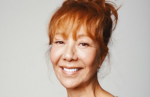 Véronique, 64 ans : fiting en « deep plane », blépharoplastie des paupières et lipostructure