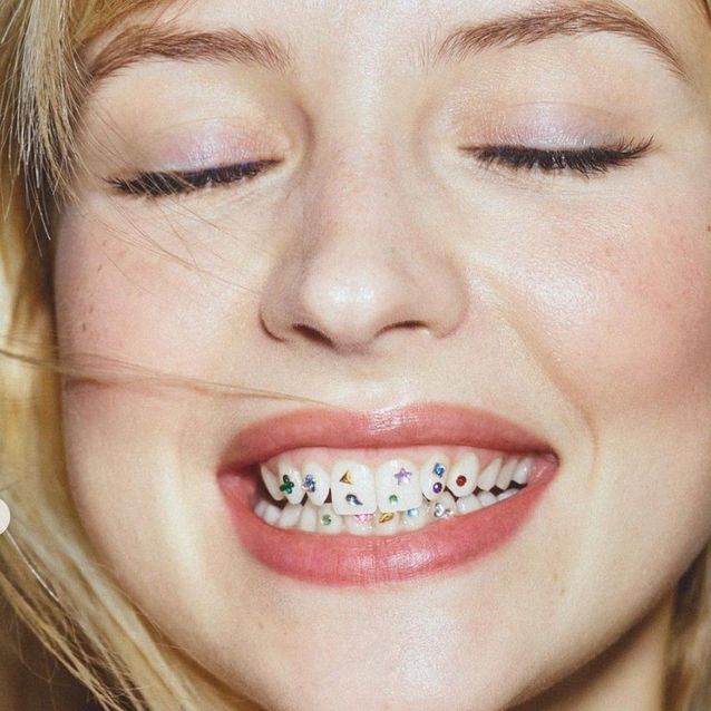 Les bijoux dentaire d'Angèle 
