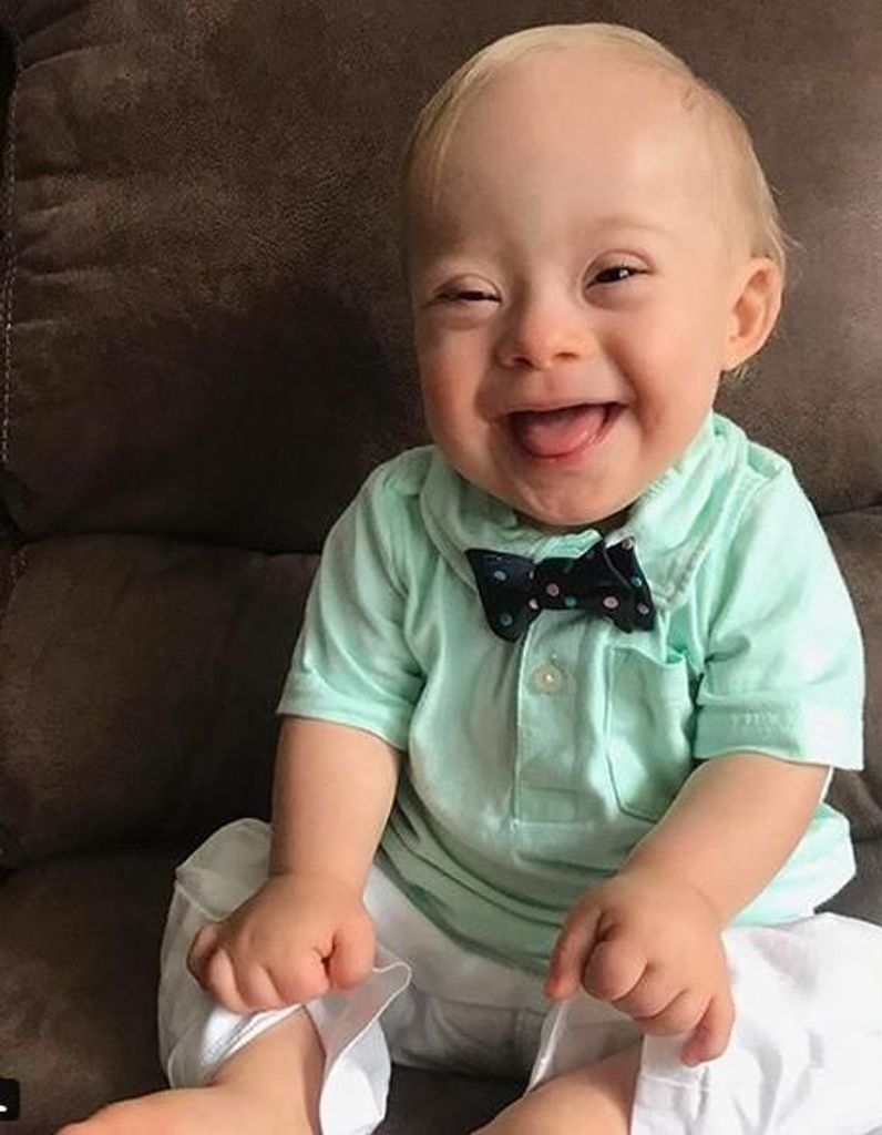 Un Bebe Trisomique Devient Enfin L Egerie D Une Celebre Marque Elle
