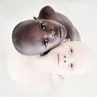Enfants albinos en Tanzanie